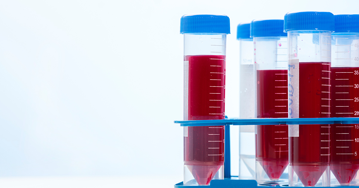 Diferenças Entre Exames De Sangue E Do Líquor No Diagnóstico De Doenças Neurológicas
