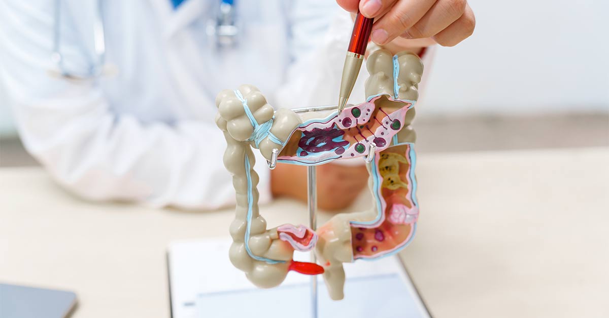 Intestino Cérebro