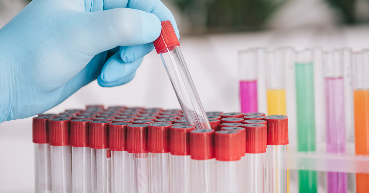 Erros Pré-analíticos Liquor