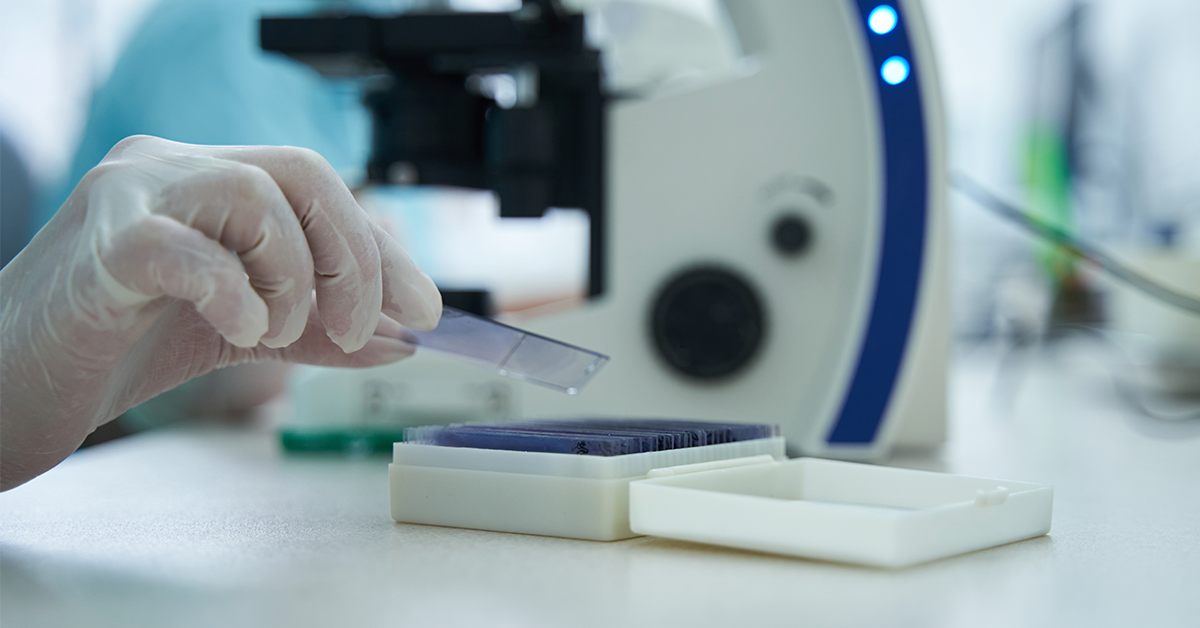 Meningite: O Que O Líquor Mostra E Por Que O Diagnóstico Precoce Importa